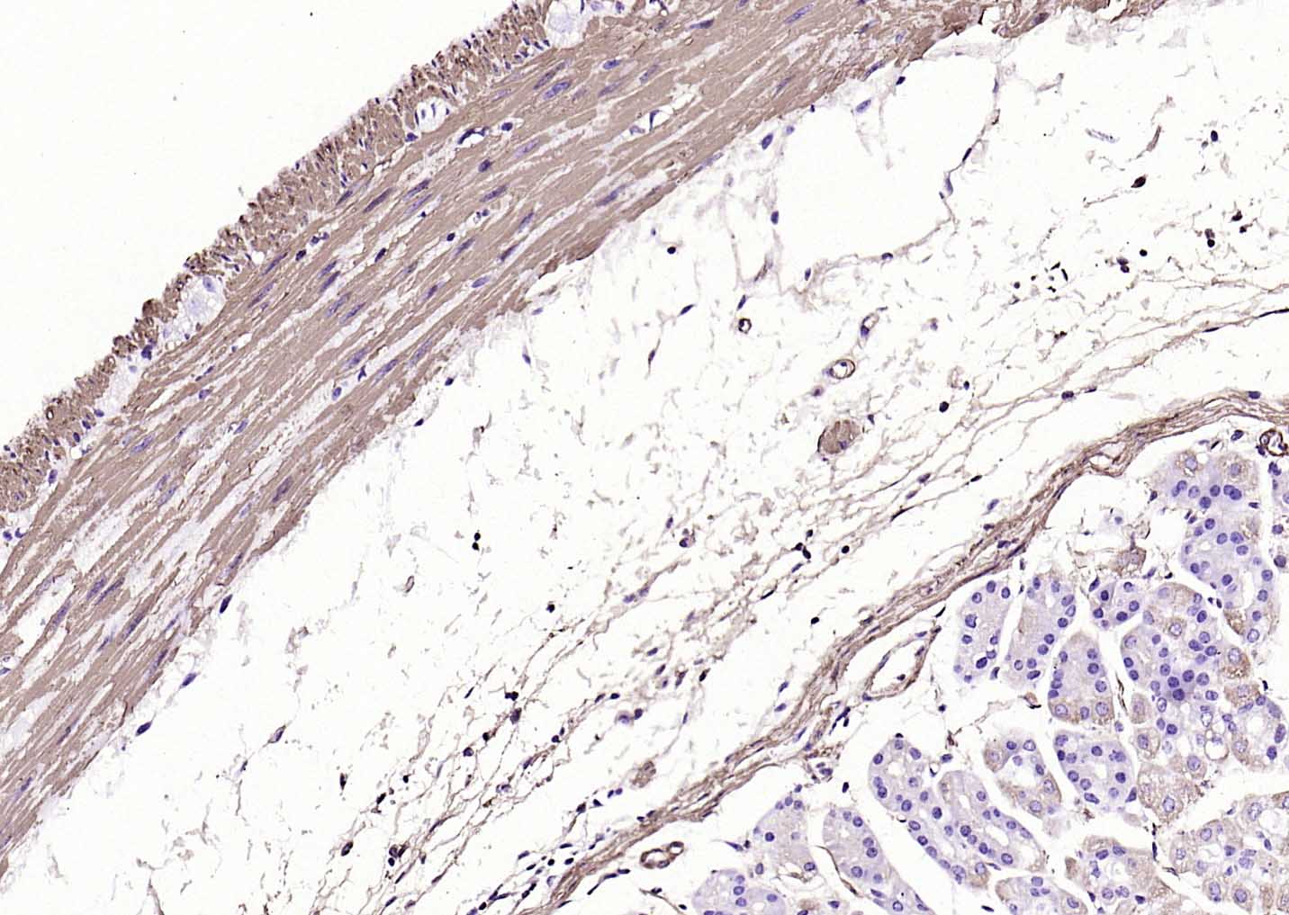 肌动蛋白α/α-SMA/α Actin单克隆抗体-bsm-33187M