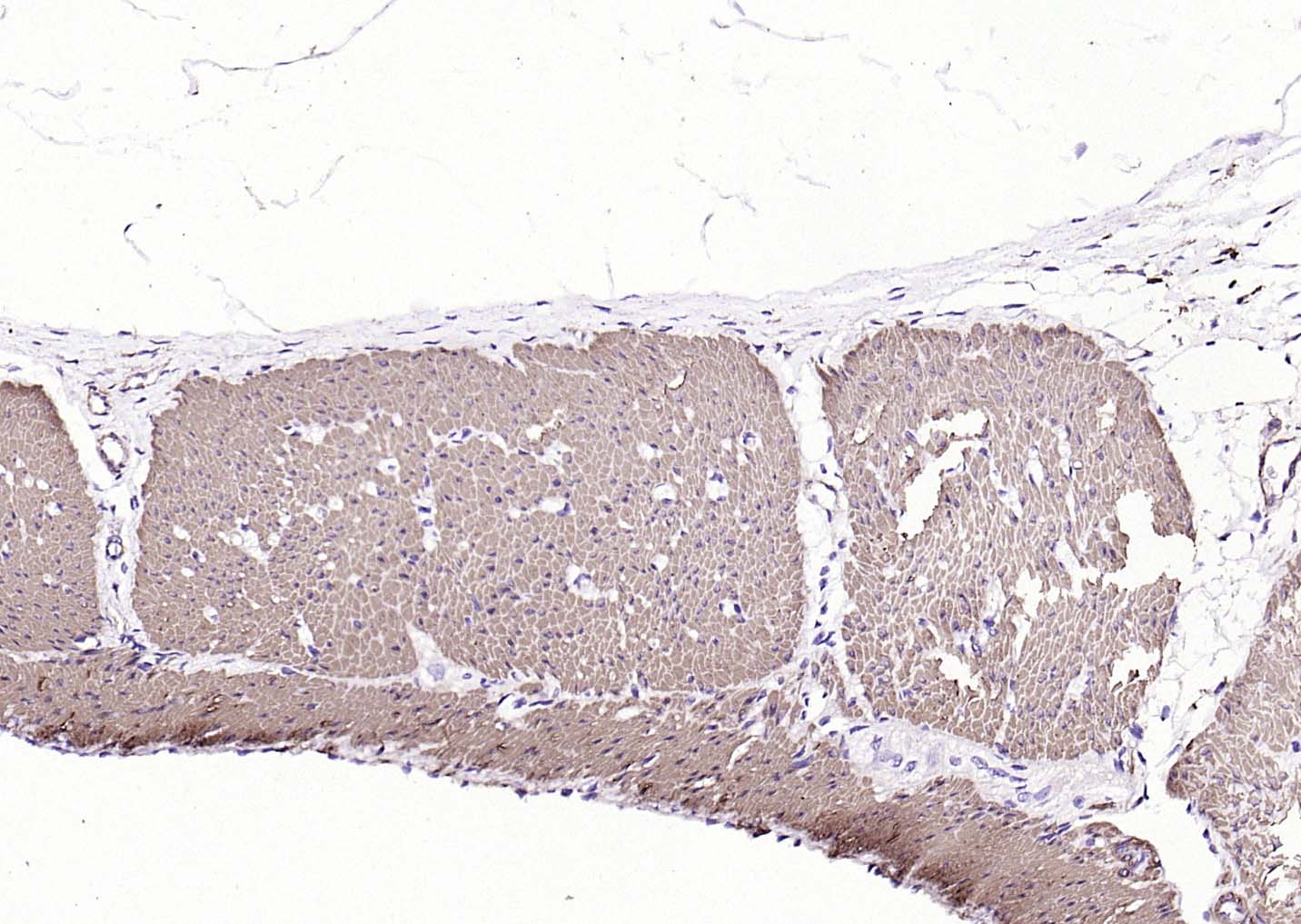 肌动蛋白α/α-SMA/α Actin单克隆抗体-bsm-33187M