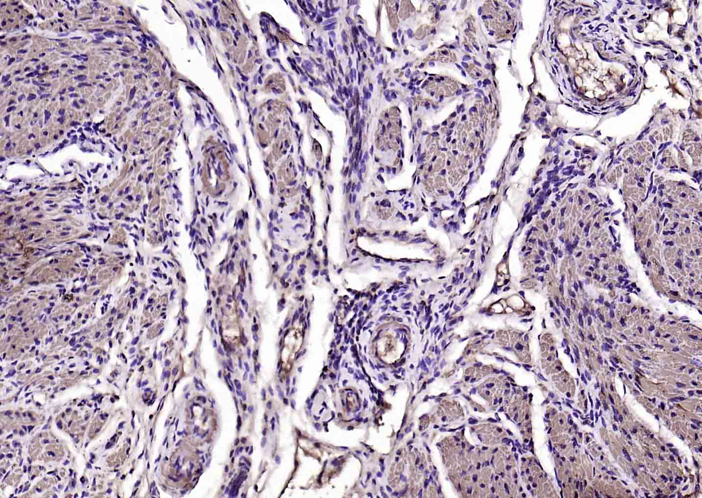 肌动蛋白α/α-SMA/α Actin单克隆抗体-bsm-33187M