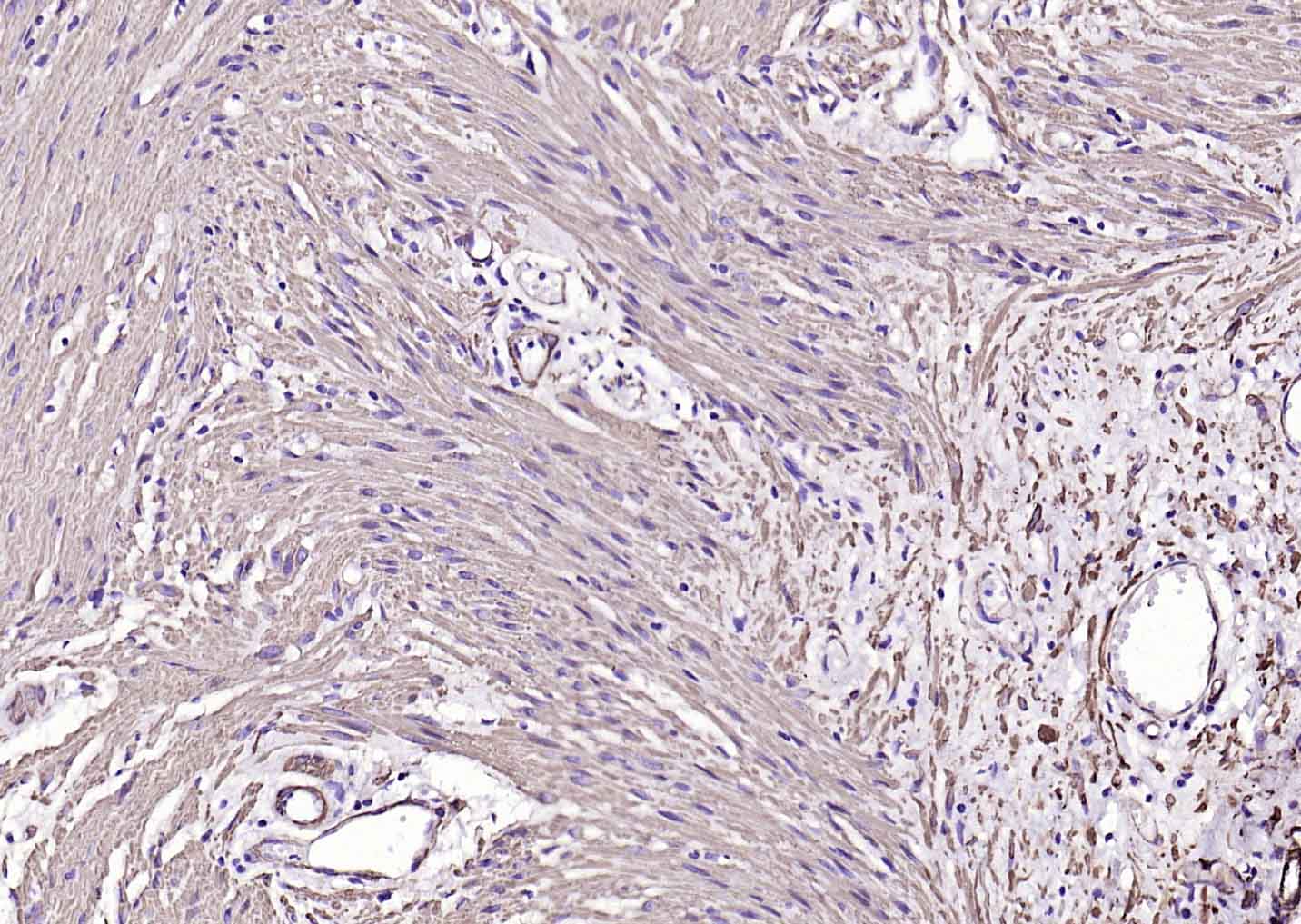 肌动蛋白α/α-SMA/α Actin单克隆抗体-bsm-33187M