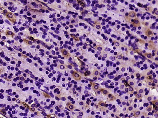 肌动蛋白α/α-SMA/α Actin单克隆抗体-bsm-33188M