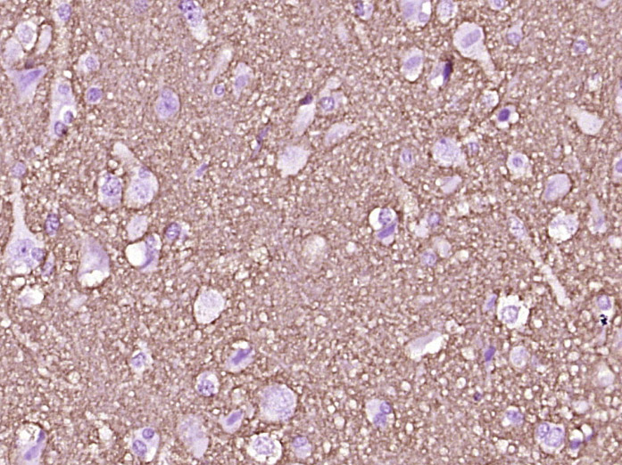 神经生长相关蛋白43单克隆抗体-bsm-33192M