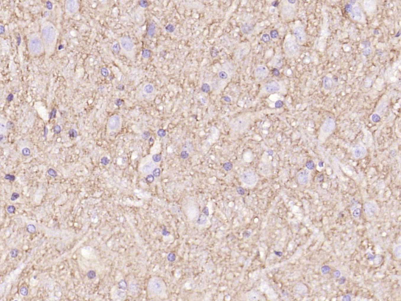 神经生长相关蛋白43单克隆抗体-bsm-33192M