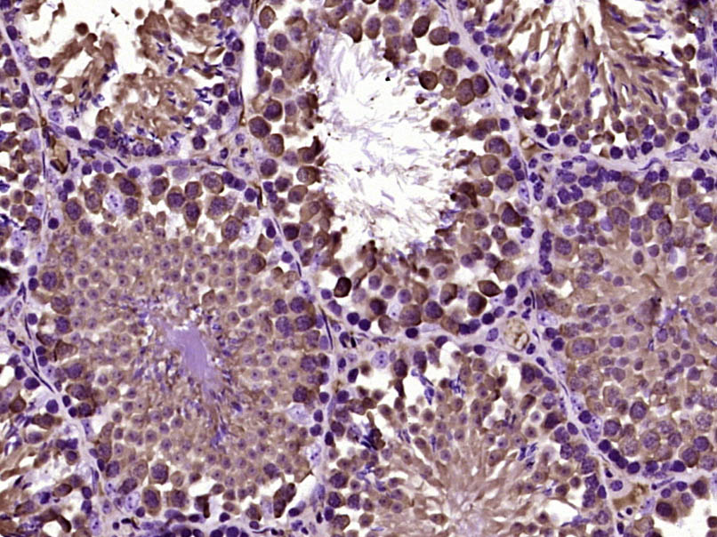 热休克蛋白71单克隆抗体-bsm-33211M