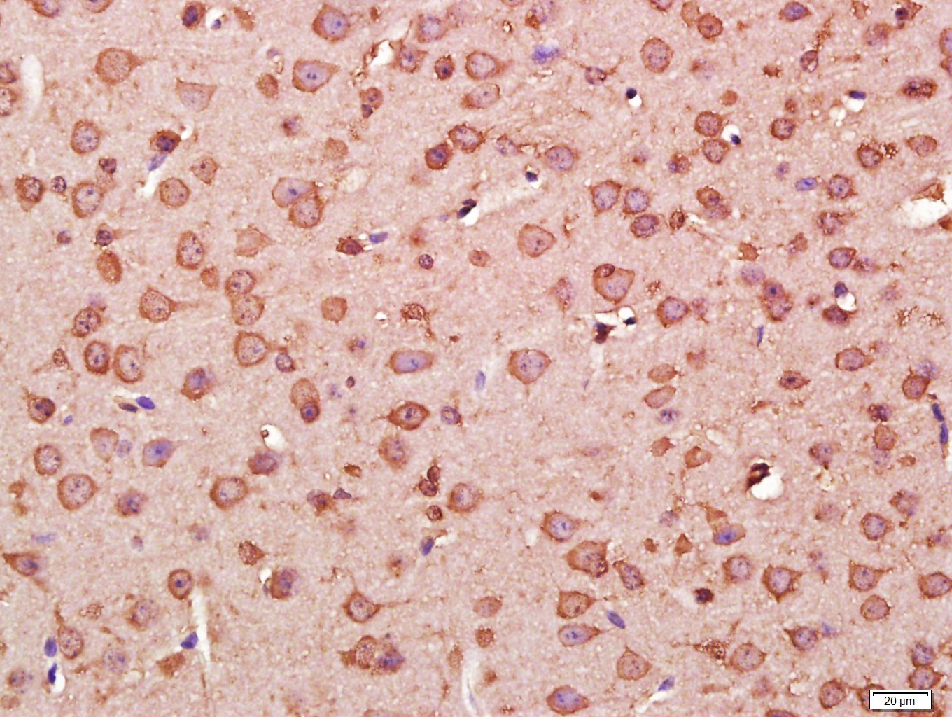 信号转导和转录激活因子3单克隆抗体-bsm-33218M