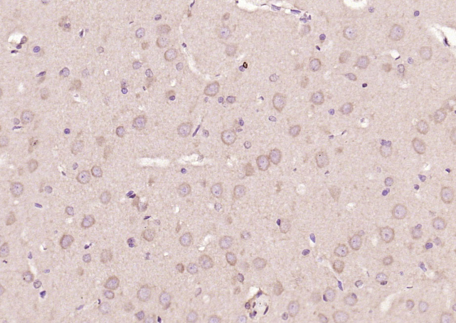 信号转导和转录激活因子3单克隆抗体-bsm-33218M