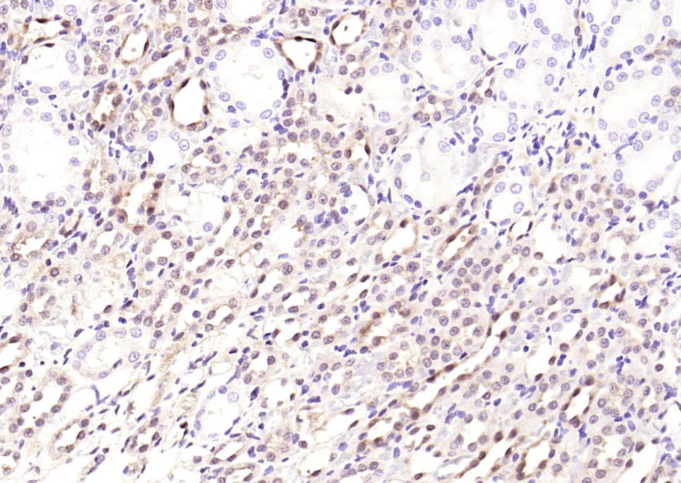 信号转导和转录激活因子3单克隆抗体-bsm-33218M