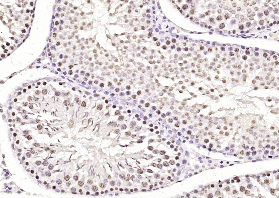TATA结合蛋白单克隆抗体-bsm-33227M