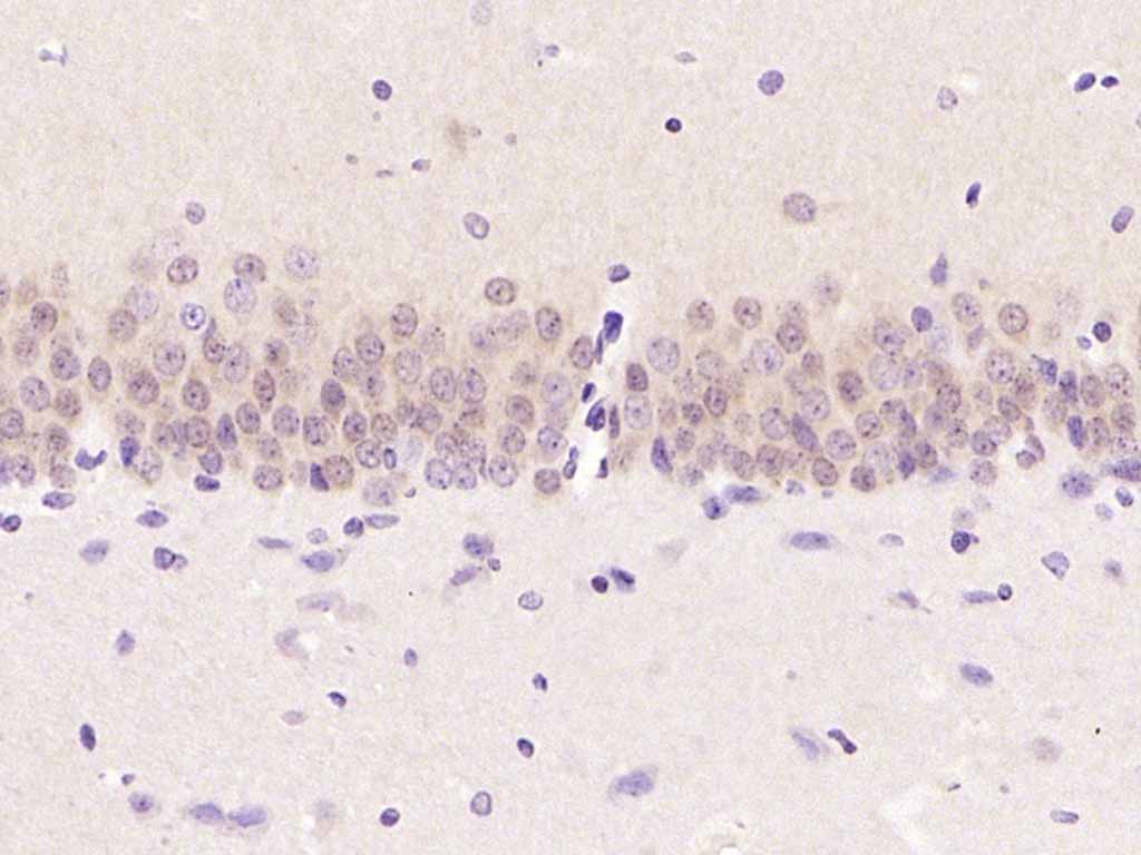丝裂原活化蛋白激酶1/2单克隆抗体-bsm-33234M