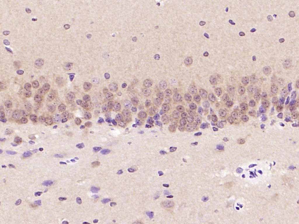 丝裂原活化蛋白激酶1/2单克隆抗体-bsm-33234M
