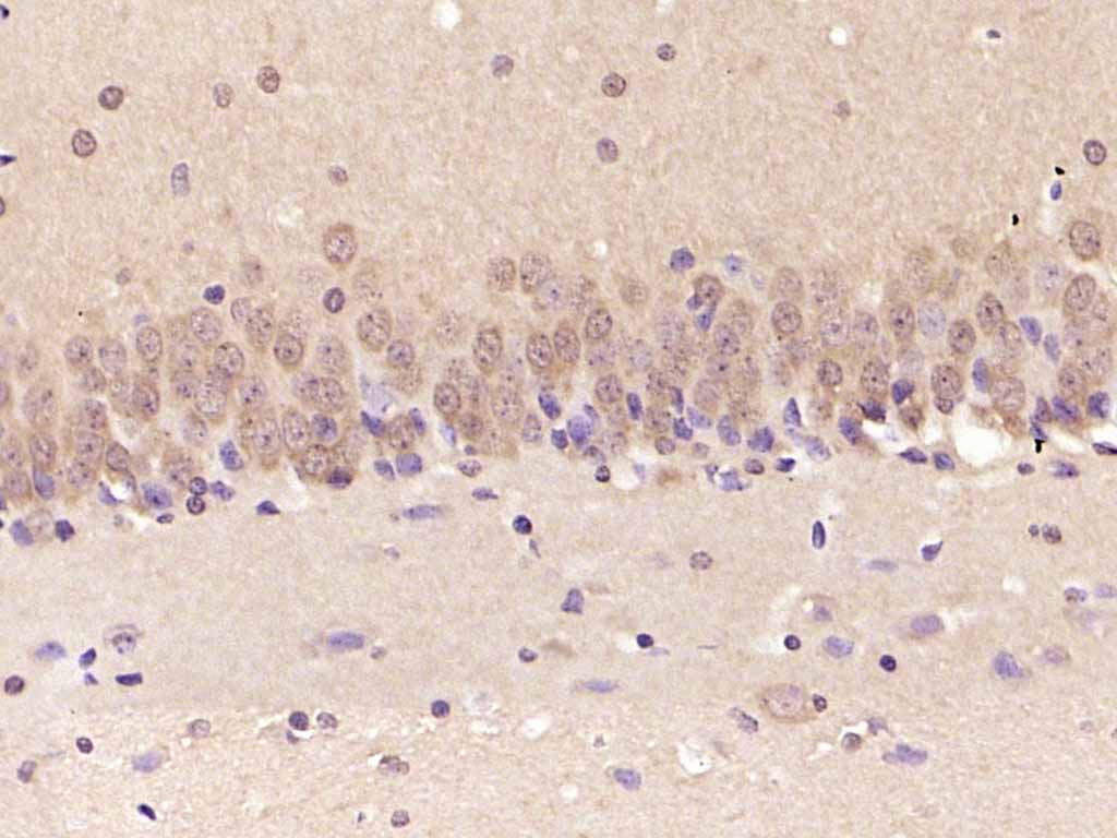 丝裂原活化蛋白激酶1/2单克隆抗体-bsm-33234M