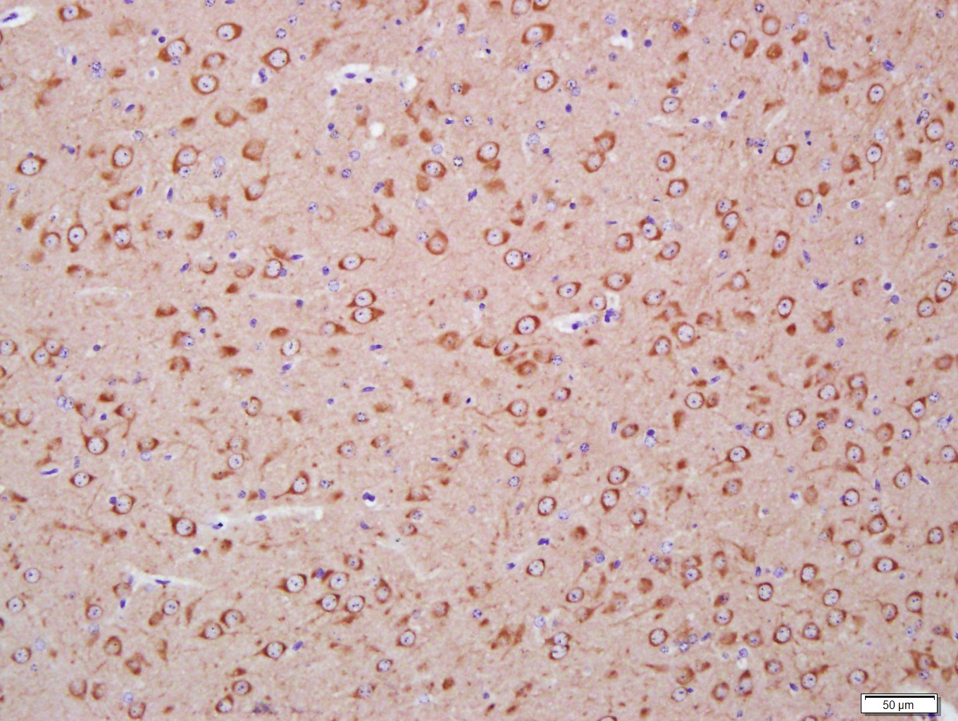 自噬微管相关蛋白轻链3单克隆抗体-bsm-33309M
