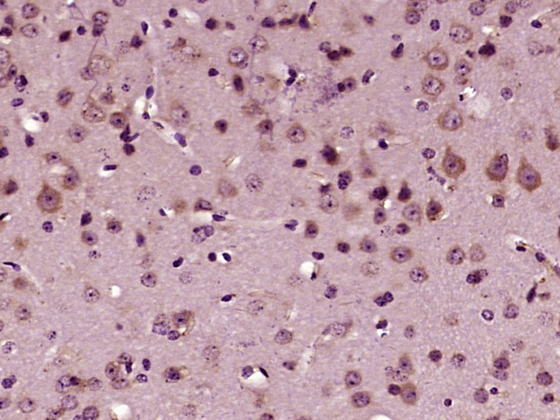 微管蛋白γ单克隆抗体-bsm-33313M