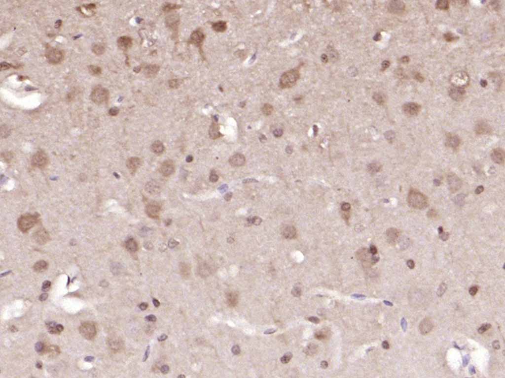 丝裂原活化蛋白激酶1/2单克隆抗体-bsm-33337M
