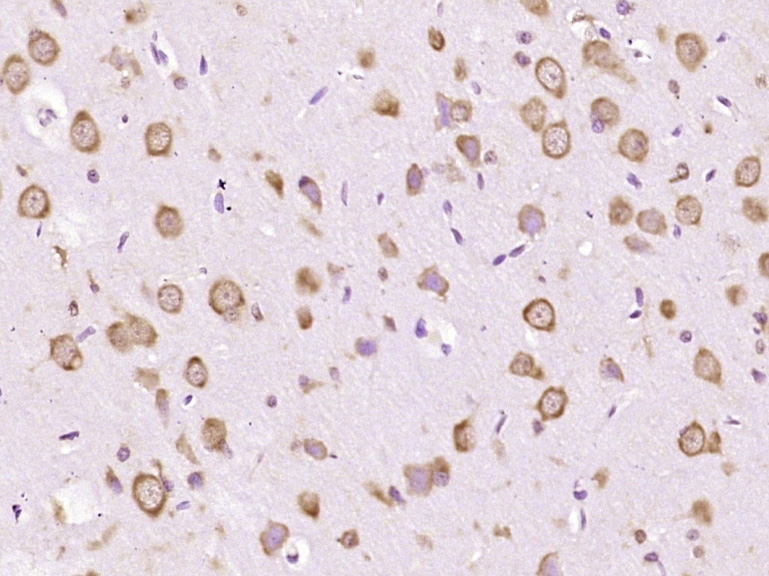 自噬蛋白5单克隆抗体-bsm-33385M