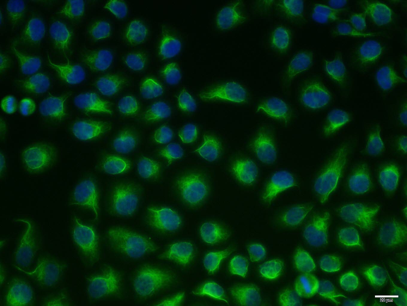 自噬蛋白5单克隆抗体-bsm-33385M