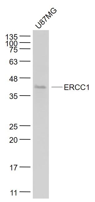 ERCC1 Mouse mAb (一抗) | Bioss