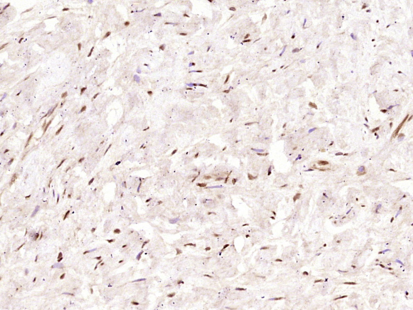 AMPK gamma1 Mouse mAb (一抗) | Bioss