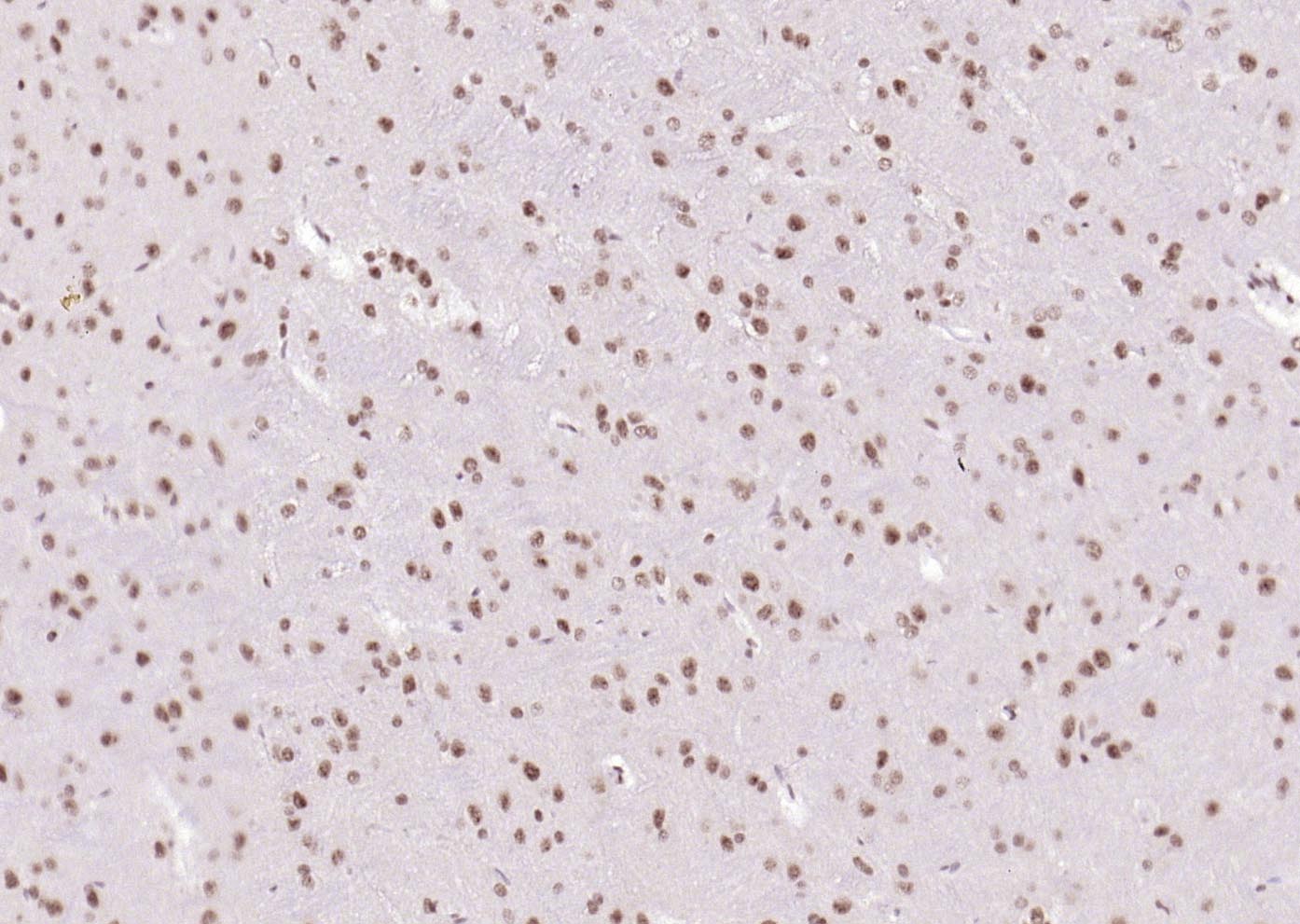 磷酸化糖原合酶激酶-3β单克隆抗体-bsm-33870M