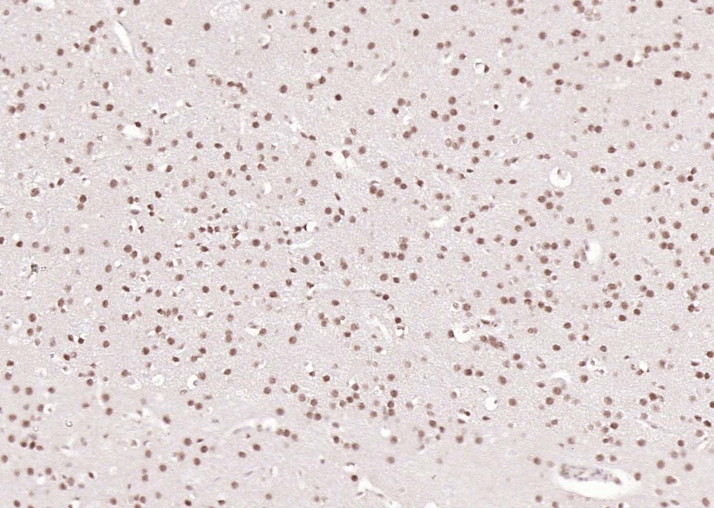 磷酸化糖原合酶激酶-3β单克隆抗体-bsm-33870M
