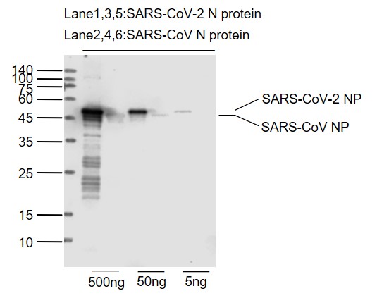 SARS-CoV-2 (2019-nCoV) Nucleocapsid