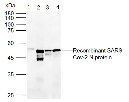 SARS-CoV-2 (2019-nCoV) Nucleocapsid