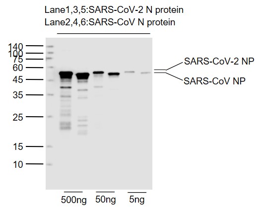 SARS-CoV-2 (2019-nCoV) Nucleocapsid