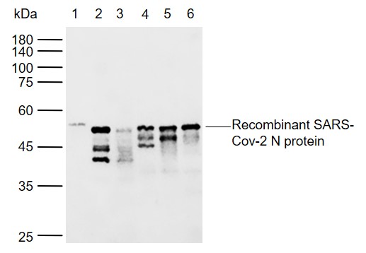SARS-CoV-2 (2019-nCoV) Nucleocapsid