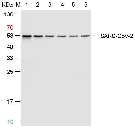 SARS-CoV-2 (2019-nCoV) Nucleocapsid