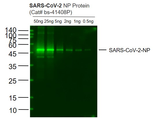 SARS-CoV-2 (2019-nCoV) Nucleocapsid