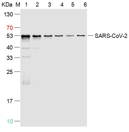 SARS-CoV-2 (2019-nCoV) Nucleocapsid