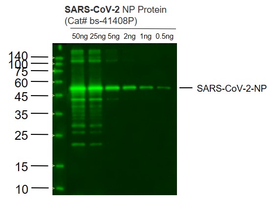 SARS-CoV-2 (2019-nCoV) Nucleocapsid