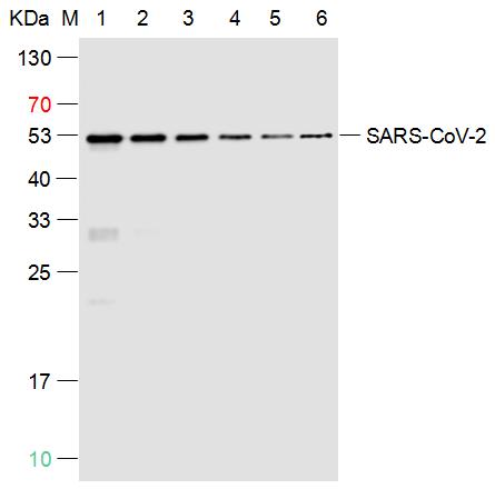 SARS-CoV-2 (2019-nCoV) Nucleocapsid