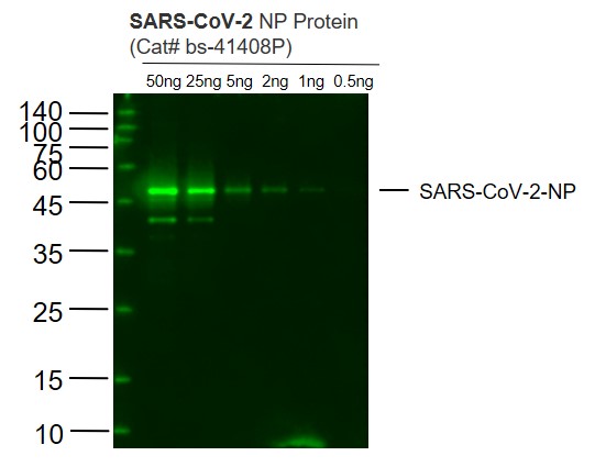 SARS-CoV-2 (2019-nCoV) Nucleocapsid
