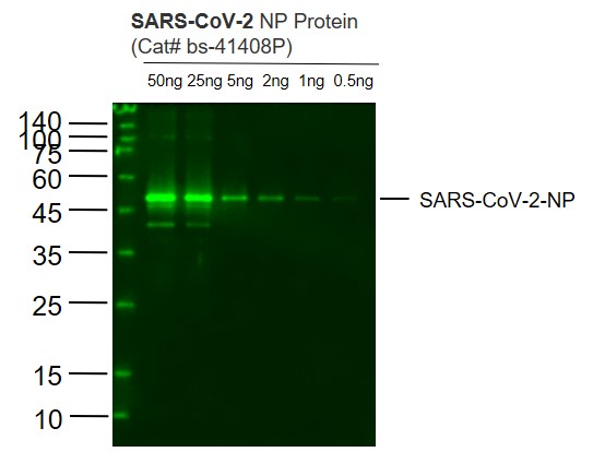 SARS-CoV-2 (2019-nCoV) Nucleocapsid