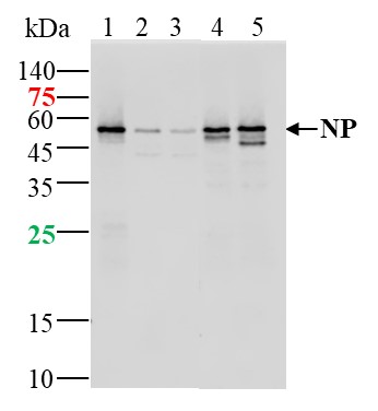 SARS-CoV-2 (2019-nCoV) Nucleocapsid,  WT & Ormicron Recognized