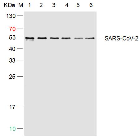 SARS-CoV-2 (2019-nCoV) Nucleocapsid,  WT & Ormicron Recognized
