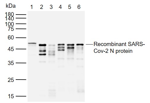SARS-CoV-2 (2019-nCoV) Nucleocapsid,  WT & Ormicron Recognized