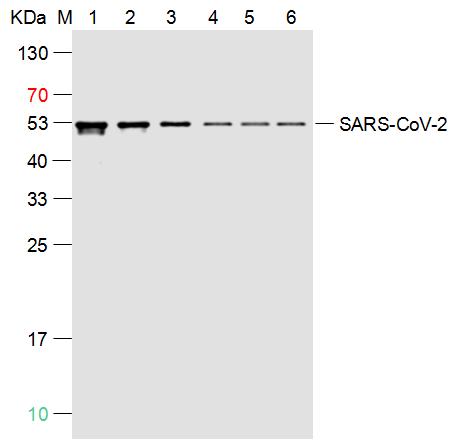 SARS-CoV-2 (2019-nCoV) Nucleocapsid, WT & Ormicron Recognized