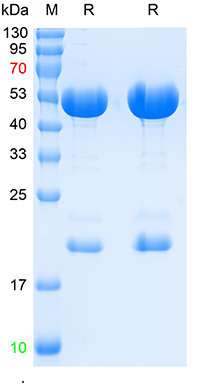 SARS-CoV-2 (2019-nCoV) Nucleocapsid, WT & Ormicron Recognized