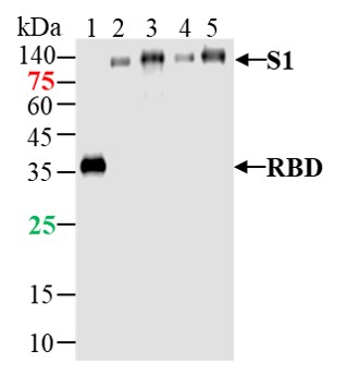 SARS-CoV-2 (2019-nCoV) Spike RBD