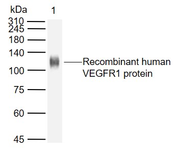 sFlt1 Mouse mAb (一抗) | Bioss