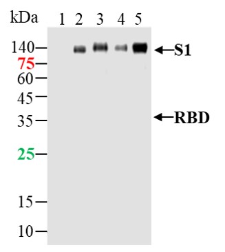 SARS-CoV-2 (2019-nCoV) Spike S1