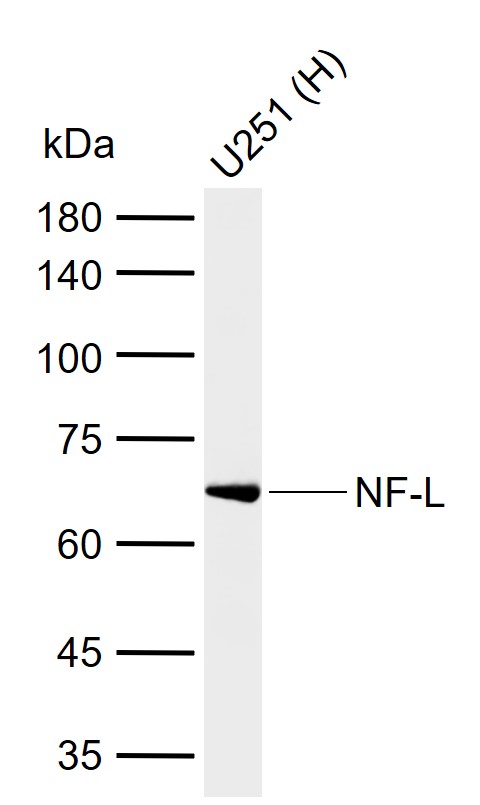 NF-L Mouse mAb (一抗) - WB,IHC-P,IHC-F,IF | Bioss