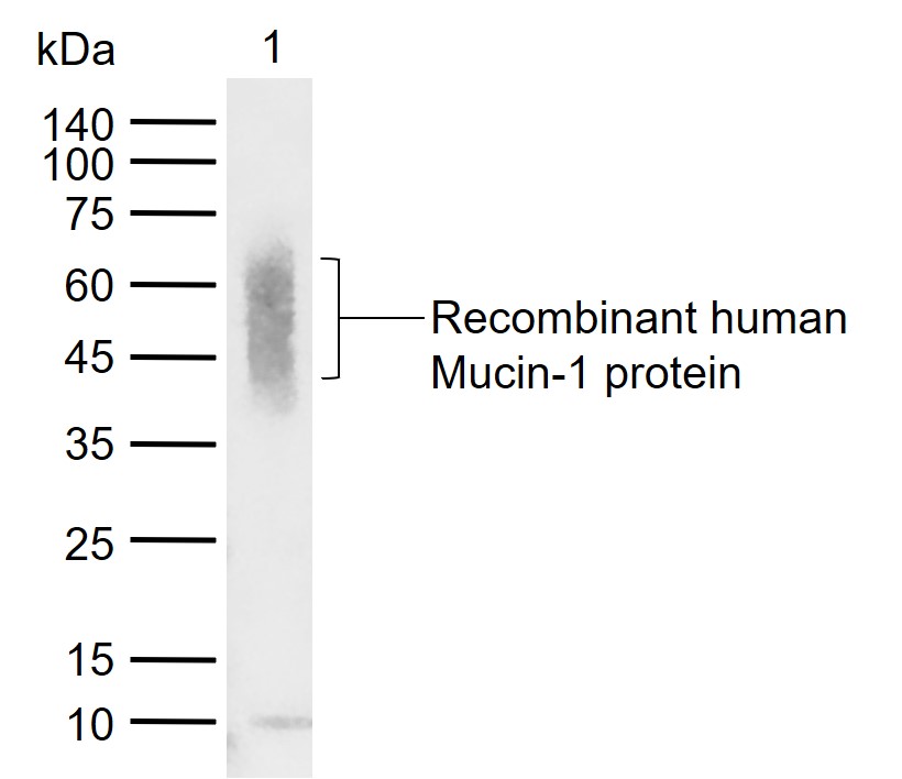 Mucin-1 Mouse mAb (一抗) | Bioss