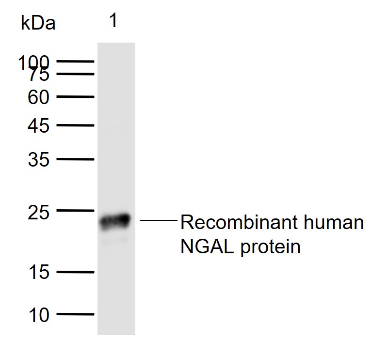 NGAL Mouse mAb (一抗) | Bioss