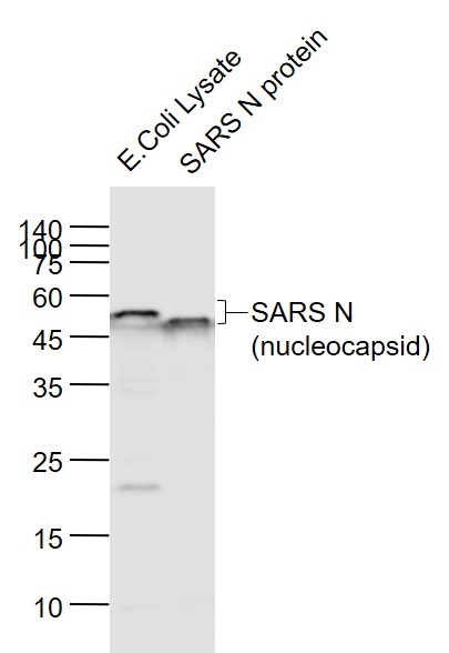 SARS-CoV Nucleocapsid