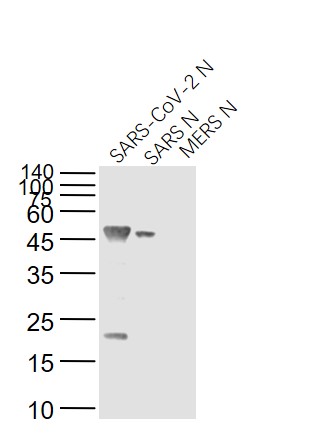 SARS-CoV Nucleocapsid