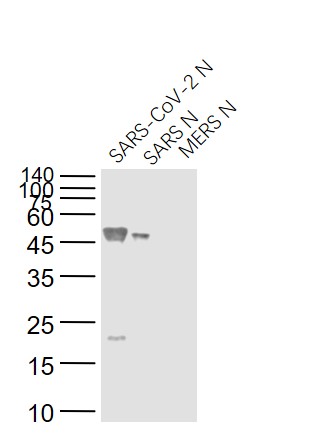SARS-CoV Nucleocapsid