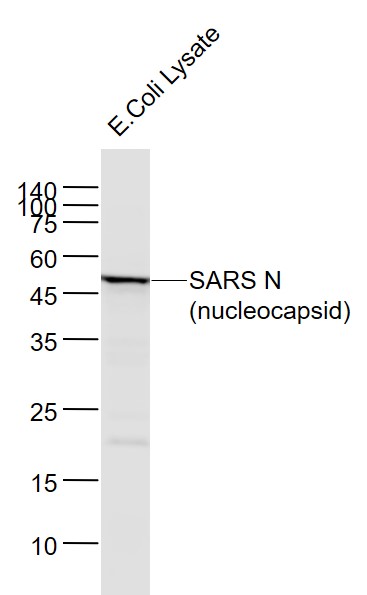 SARS-CoV Nucleocapsid